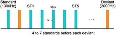 Neural response to repeated auditory stimuli and its association with early language ability in male children with Fragile X syndrome